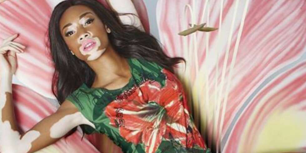 UNIK SKJØNNHET: Chantelle Brown fronter en reklamekampanje for kleskjeden Desigual. UNIK SKJØNNHET: Chantelle Brown fronter en reklamekampanje for kleskjeden Desigual.