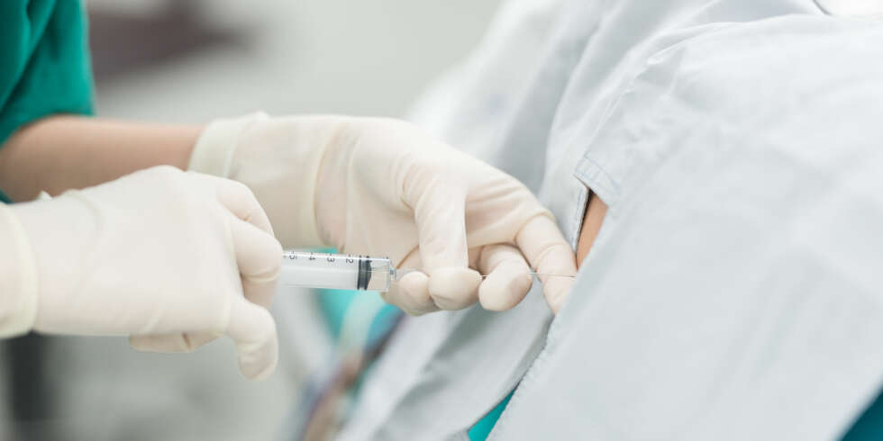VANLIG MED EPIDURAL: Epidural er en vanlig smertelindring under fødselen. VANLIG MED EPIDURAL: Epidural er en vanlig smertelindring under fødselen.