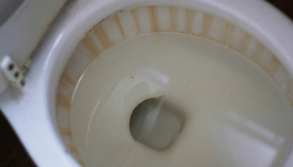 BRUNT BELEGG I DO: Dersom du slurver med toalettvasken eller bruker feil vaskemidler, kan det danne seg et ekkelt, brunt belegg nede i toalettskålen. BRUNT BELEGG I DO: Dersom du slurver med toalettvasken eller bruker feil vaskemidler, kan det danne seg et ekkelt, brunt belegg nede i toalettskålen.