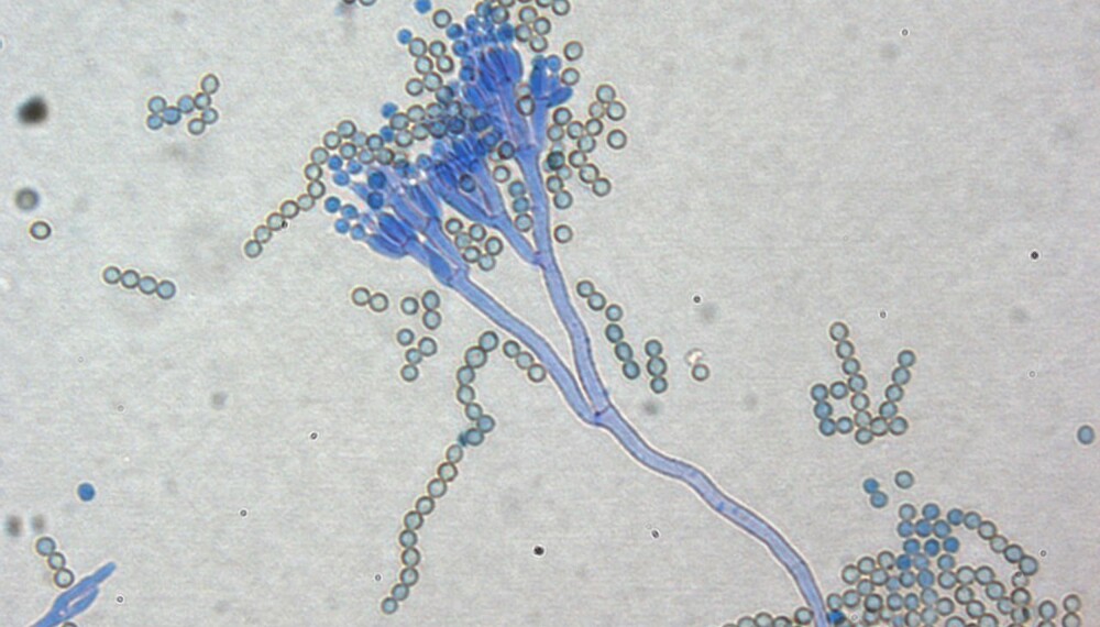 MUGGSOPP I VED: Visste du at det er svært vanlig å få med seg muggsopp inn i boligen sammen med veden? På bildet ser du penicillinmugg (Penicillium chrysogenum) - hentet fra en muggen vedkubbe. MUGGSOPP I VED: Visste du at det er svært vanlig å få med seg muggsopp inn i boligen sammen med veden? På bildet ser du penicillinmugg (Penicillium chrysogenum) - hentet fra en muggen vedkubbe.