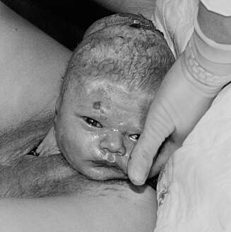 MAGISK ØYEBLIKK: 7. november 2001 ble Alfred født. Eva forteller at dette er den fødselen som har gjort størst inntrykk på henne. Spesielt da hun oppdaget at Alfred så rett i kamera da han kom til verden. MAGISK ØYEBLIKK: 7. november 2001 ble Alfred født. Eva forteller at dette er den fødselen som har gjort størst inntrykk på henne. Spesielt da hun oppdaget at Alfred så rett i kamera da han kom til verden.