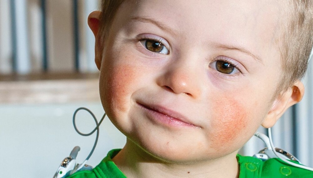 SKJULTE HANDIKAP: Lauritz Østbøll er ikke helt som andre 3-åringer. Han har Downs, og han er døv. SKJULTE HANDIKAP: Lauritz Østbøll er ikke helt som andre 3-åringer. Han har Downs, og han er døv.