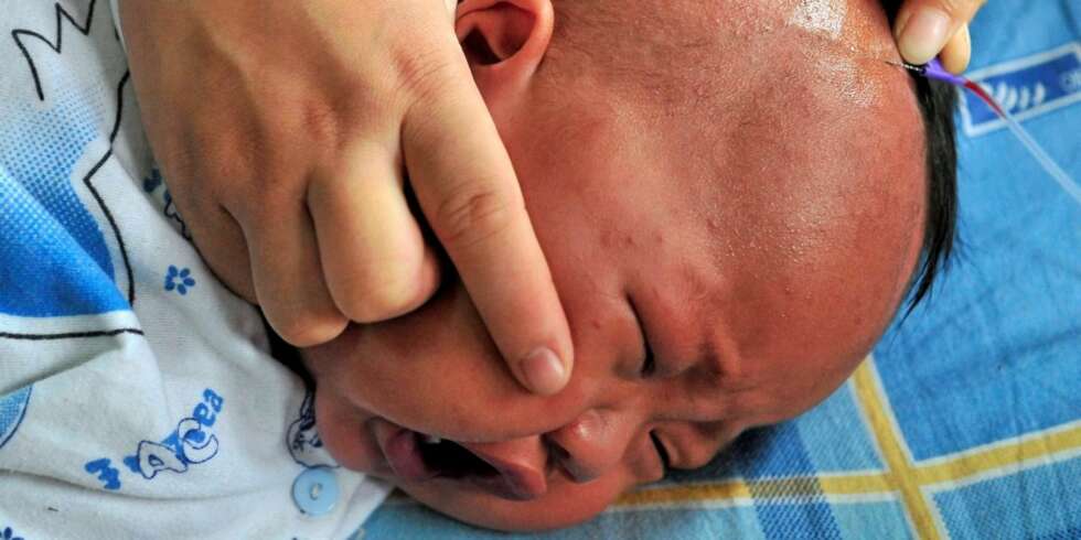 Mao Yongjie, er ni måneder og lider av nyretsein på sykehus i Hefei, i Anhui provinsen i Kina Mao Yongjie, er ni måneder og lider av nyretsein på sykehus i Hefei, i Anhui provinsen i Kina