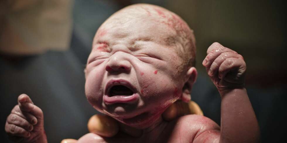 NYFØDT BABY: Noen mener nyfødte babyer ser ut som gamle menn. Er du enig? NYFØDT BABY: Noen mener nyfødte babyer ser ut som gamle menn. Er du enig?