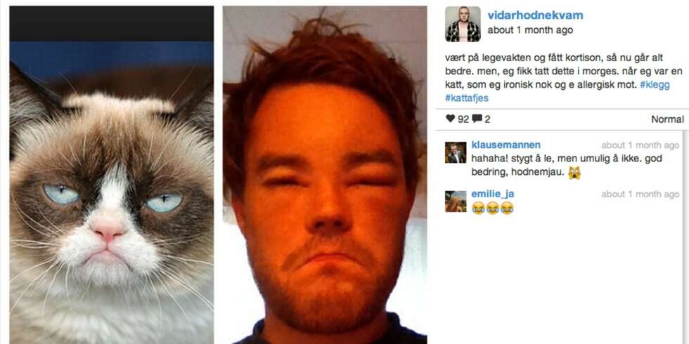 SELVIRONI: Komiker Vidar Hodnekvam hadde ingen problemer med å se likheten mellom seg selv og en katt da ansiktet hovnet opp etter kleggstikk. SELVIRONI: Komiker Vidar Hodnekvam hadde ingen problemer med å se likheten mellom seg selv og en katt da ansiktet hovnet opp etter kleggstikk.