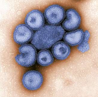 VIRUSET: Fotografi av Influensa A H1N1 gjennom mikroskop. VIRUSET: Fotografi av Influensa A H1N1 gjennom mikroskop.