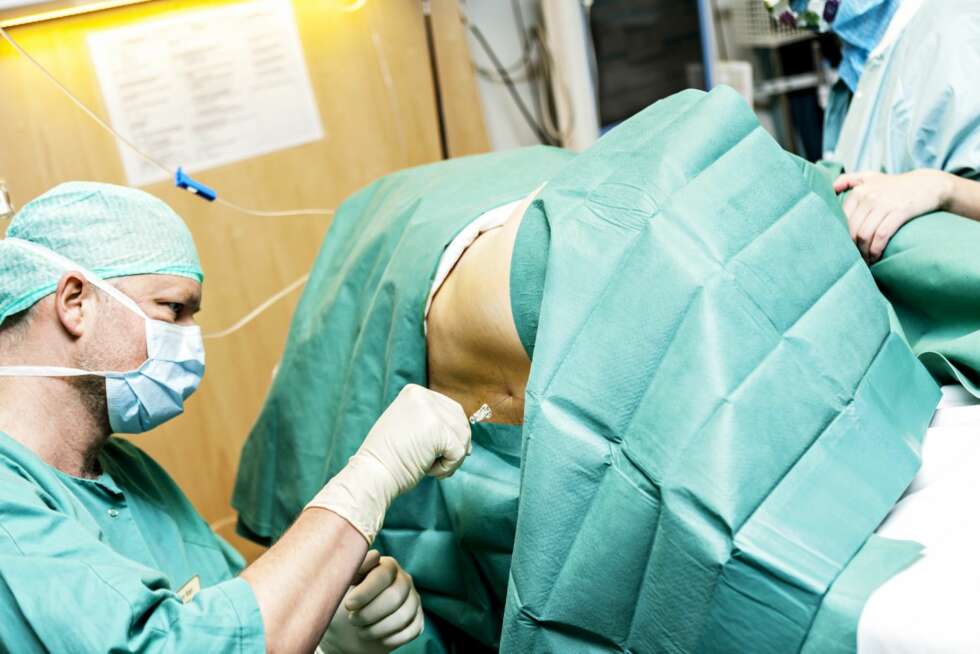 IKKE NARKOSE: Spinalbedøvelsen i ryggen går raskere ut av kroppen enn narkose. Dermed kommer pasienten seg fortere på bena etter operasjonen. ¿ Det gir bedre blodsirkulasjon og forebygger blodpropp, forklarer anestesilege Torbjørn Rian. IKKE NARKOSE: Spinalbedøvelsen i ryggen går raskere ut av kroppen enn narkose. Dermed kommer pasienten seg fortere på bena etter operasjonen. ¿ Det gir bedre blodsirkulasjon og forebygger blodpropp, forklarer anestesilege Torbjørn Rian.