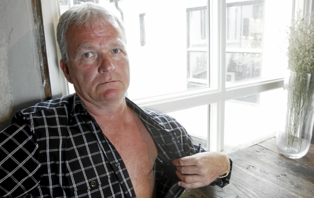 BRYSTKREFT: I dag er det bare et 20 cm langt arr der brystet var, som sladrer om det Rune Martinsen har vært igjennom. BRYSTKREFT: I dag er det bare et 20 cm langt arr der brystet var, som sladrer om det Rune Martinsen har vært igjennom.