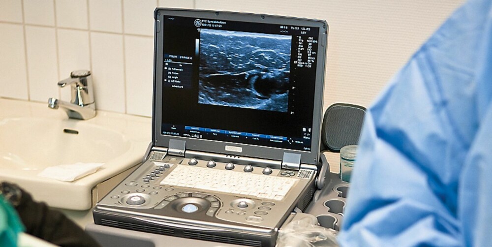 ULTRALYD: Ultralyd er et uunnværlig verktøy også under inngrepet. Med gjennomlysende ultralyd navigerer kirurgen den én mm tykke laserfiberen inn i venen som skal brennes vekk helt opp til lysken. ULTRALYD: Ultralyd er et uunnværlig verktøy også under inngrepet. Med gjennomlysende ultralyd navigerer kirurgen den én mm tykke laserfiberen inn i venen som skal brennes vekk helt opp til lysken.