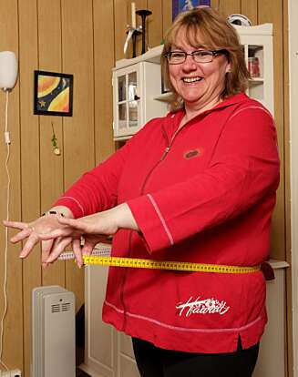 IKKE SUPERMODELL: - Når folk hører at man har tatt en gastric bypass, forventer de at man er kjempetynn, men det er jo ikke det som er målet, sier Kari-Ann Lamøy. IKKE SUPERMODELL: - Når folk hører at man har tatt en gastric bypass, forventer de at man er kjempetynn, men det er jo ikke det som er målet, sier Kari-Ann Lamøy.