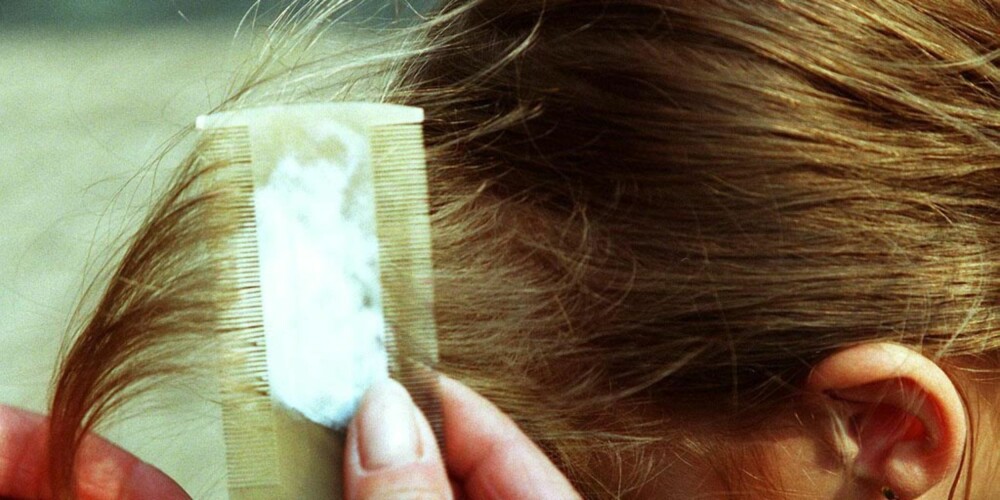 LUSEKAM: Bruk gjerne balsam for å lette kjemmingen, og gre helt fra hodebunnen. ILLUSTRASJONSFOTO: Thinkstock LUSEKAM: Bruk gjerne balsam for å lette kjemmingen, og gre helt fra hodebunnen. ILLUSTRASJONSFOTO: Thinkstock