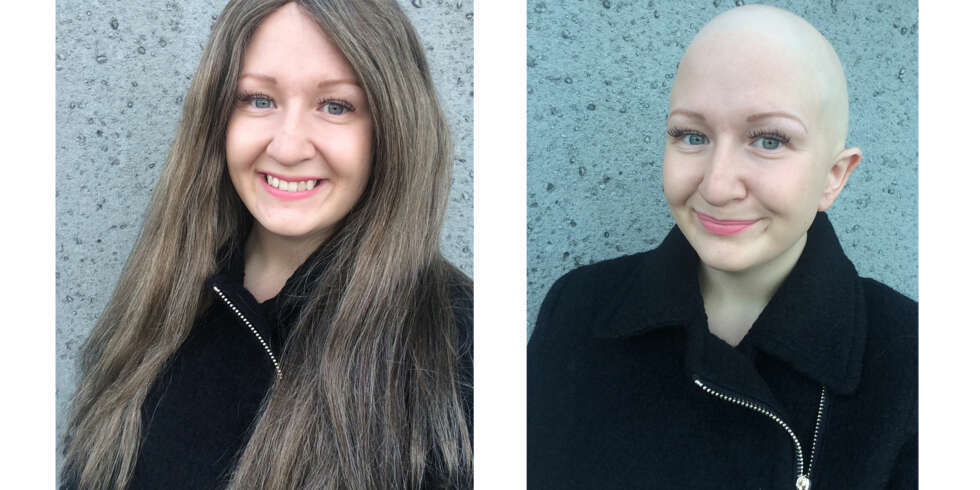 ALOPECIA: Rebecca Eilevstøl (23) forteller at det har vært veldig viktig for henne å finne positive sider ved å ikke ha hår, og i dag er det ikke lenger så vanskelig å finne dem. FOTO: Privat ALOPECIA: Rebecca Eilevstøl (23) forteller at det har vært veldig viktig for henne å finne positive sider ved å ikke ha hår, og i dag er det ikke lenger så vanskelig å finne dem. FOTO: Privat