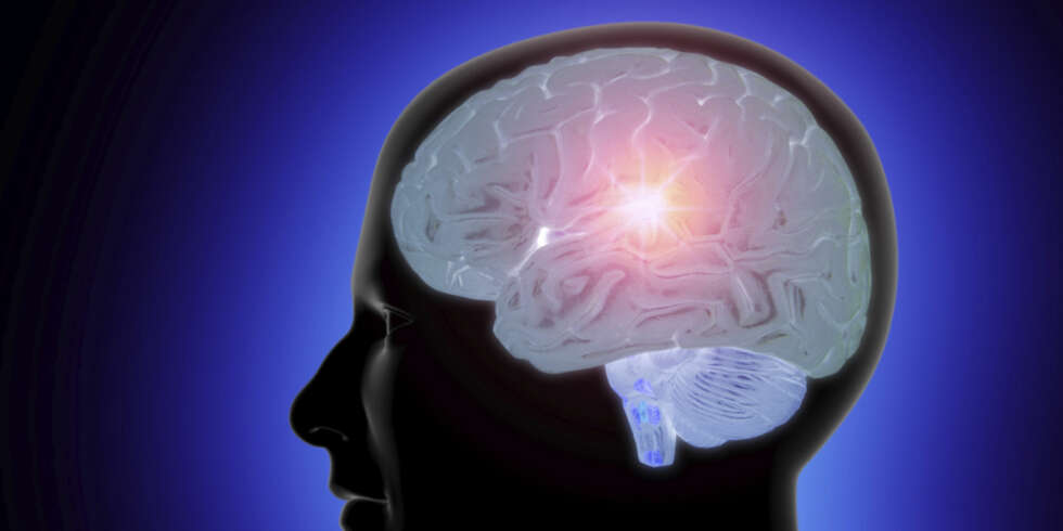 GENI? Da har du større sjanse for å bli olding, ifølge en ny undersøkelse om sammenhengen mellom intelligens og død i ung alder. GENI? Da har du større sjanse for å bli olding, ifølge en ny undersøkelse om sammenhengen mellom intelligens og død i ung alder.