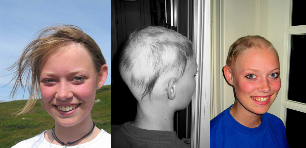 MISTET HÅRET: Oda som 12-åring, mens hun hadde hår. Før jul, da hun var 13 år, var hun i ferd med å miste alt håret. MISTET HÅRET: Oda som 12-åring, mens hun hadde hår. Før jul, da hun var 13 år, var hun i ferd med å miste alt håret.