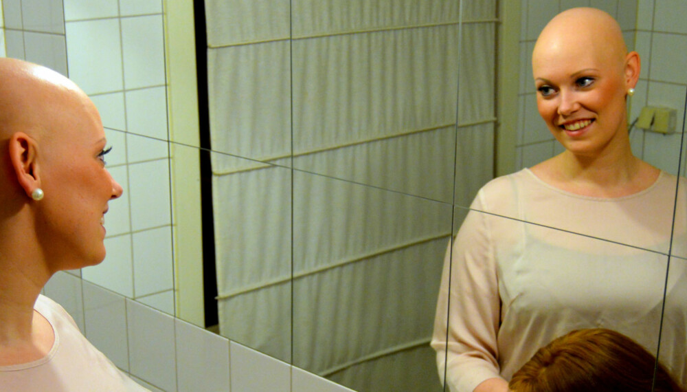 UTEN PARYKK: Oda Nybakken Molstad (23) har sykdommen Alopecia Areata som har resultert i hårtap på hele kroppen. UTEN PARYKK: Oda Nybakken Molstad (23) har sykdommen Alopecia Areata som har resultert i hårtap på hele kroppen.