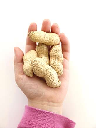 FLERE ALLERGIKERE: Peanøttallergi er blant allergiene som øker mest. Barn er spesielt kraftig rammet. FLERE ALLERGIKERE: Peanøttallergi er blant allergiene som øker mest. Barn er spesielt kraftig rammet.