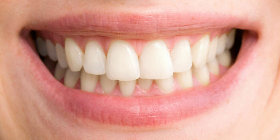 FLOTT SMIL: Uten de isende smertene smiler du lettere. Foto: COLOURBOX FLOTT SMIL: Uten de isende smertene smiler du lettere. Foto: COLOURBOX