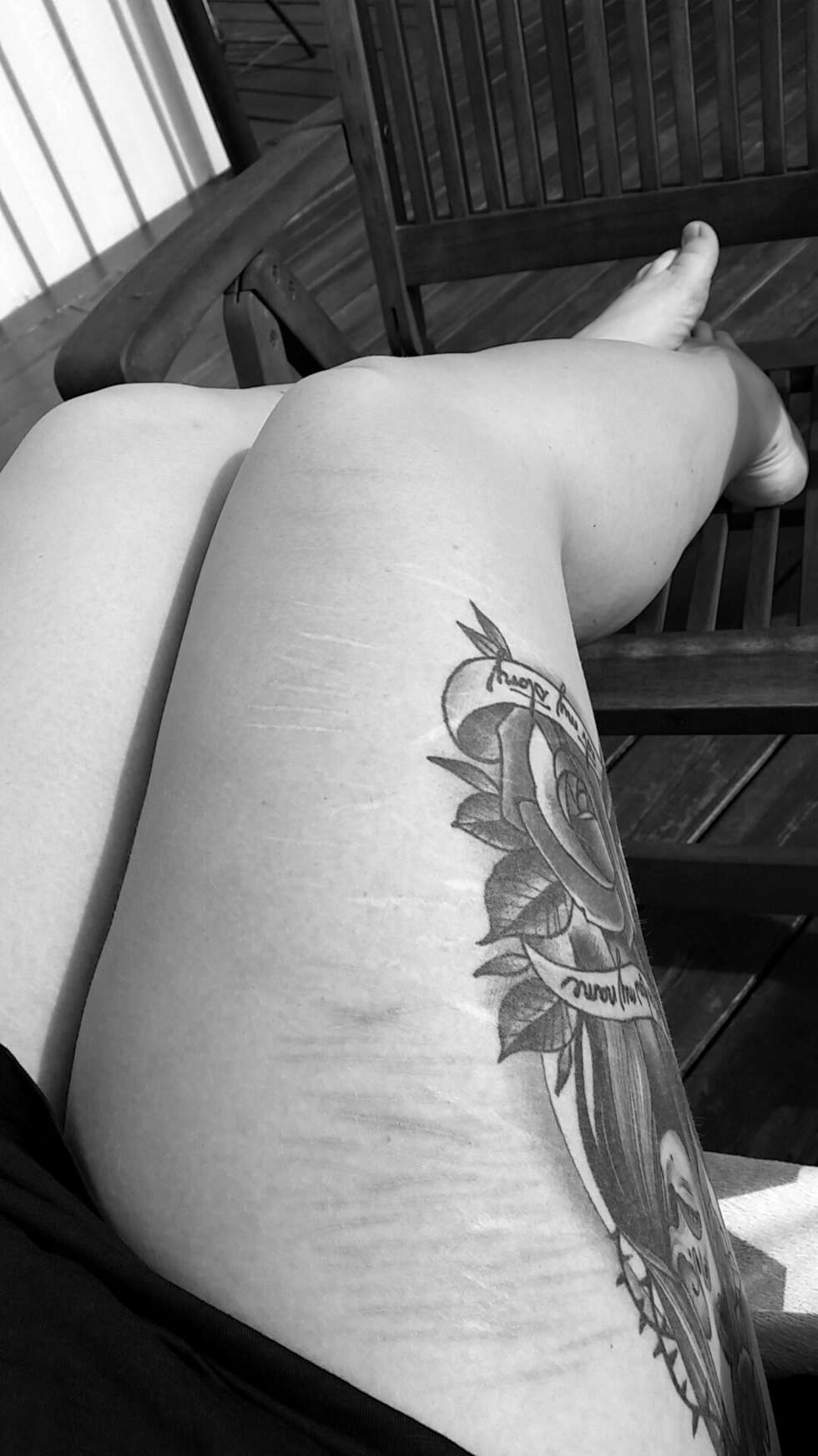 TATOVERING: Linda har tatovert over arrene på låret. Nå slipper hun å se dem hele tiden. TATOVERING: Linda har tatovert over arrene på låret. Nå slipper hun å se dem hele tiden.