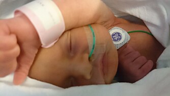 TØFF START: På grunn av endometriosen fikk Beate nyresvikt i svangerskapets uke 29. Tre uker senere var hennes indre organer og barnet i magen så påvirket at lille Ronja måtte hentes ut med keisersnitt. Det sto om livet for både mor og barn. TØFF START: På grunn av endometriosen fikk Beate nyresvikt i svangerskapets uke 29. Tre uker senere var hennes indre organer og barnet i magen så påvirket at lille Ronja måtte hentes ut med keisersnitt. Det sto om livet for både mor og barn.