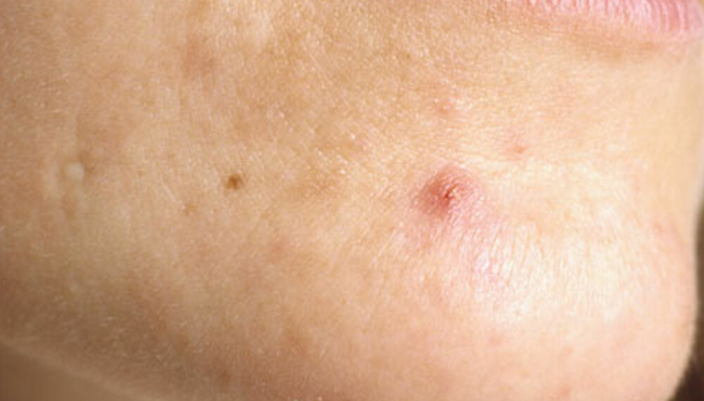 FACEMAPPING: Ifølge kinesisk medisin er det en direkte link mellom ulike soner i fjeset ditt og de forskjellige organene inne i kroppen. FACEMAPPING: Ifølge kinesisk medisin er det en direkte link mellom ulike soner i fjeset ditt og de forskjellige organene inne i kroppen.