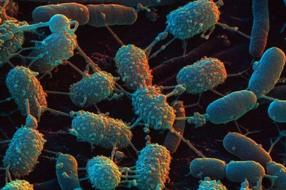 LISTERIA: Trives på kjøkkenklut, men man ser heldigvis få utbrudd av dette i Norge. FOTO: Glogster.com. LISTERIA: Trives på kjøkkenklut, men man ser heldigvis få utbrudd av dette i Norge. FOTO: Glogster.com.