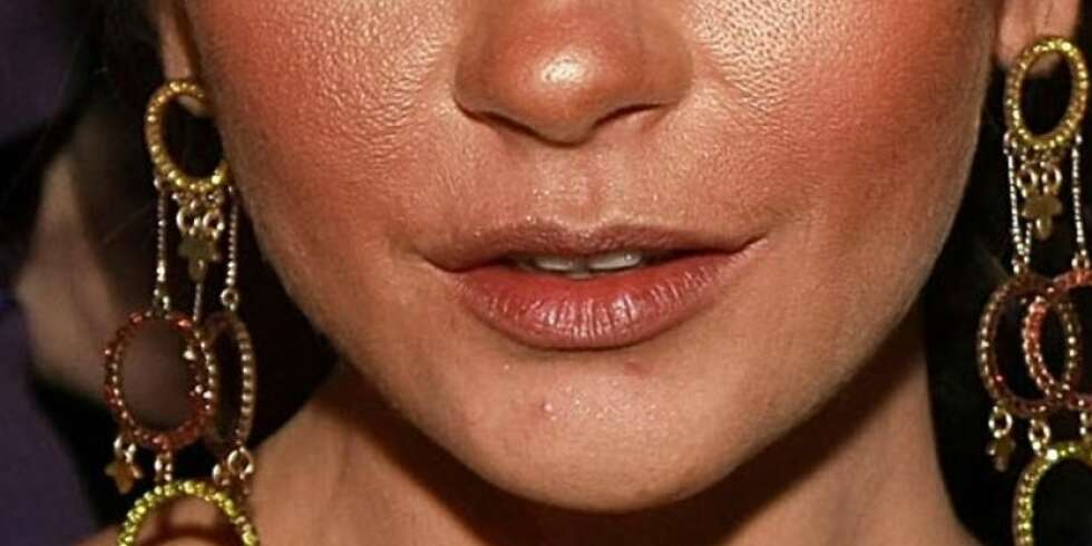 FOR MYE AV DET GODE: Til og med kjendisene bommer på solpudderet fra tid til annen, noe Catherine Zeta Jones er et godt eksempel på! FOR MYE AV DET GODE: Til og med kjendisene bommer på solpudderet fra tid til annen, noe Catherine Zeta Jones er et godt eksempel på!