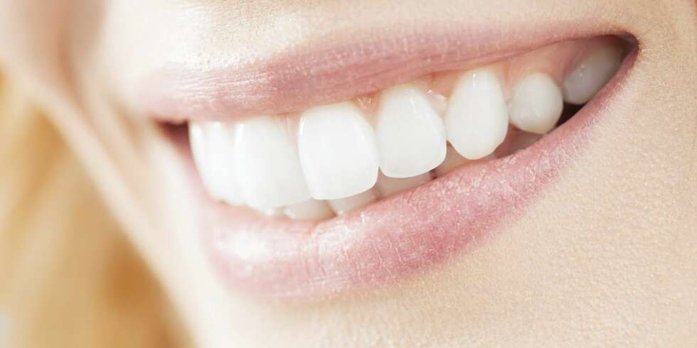 BEHOLD DET HVITE SMILET: Lilla tenner, blå tunge og flekkete lepper må være en av de få tingene som ikke engang kler den smukke... BEHOLD DET HVITE SMILET: Lilla tenner, blå tunge og flekkete lepper må være en av de få tingene som ikke engang kler den smukke...