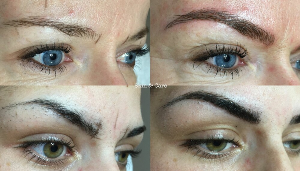 3D-BRYN: Har du hørt om den nye brynstrenden microblading? Her utført av behandler Sarah Gallor ved Skin & Care. (Klikk Mote har særskilt tillatelse til å benytte bildene) 3D-BRYN: Har du hørt om den nye brynstrenden microblading? Her utført av behandler Sarah Gallor ved Skin & Care. (Klikk Mote har særskilt tillatelse til å benytte bildene)