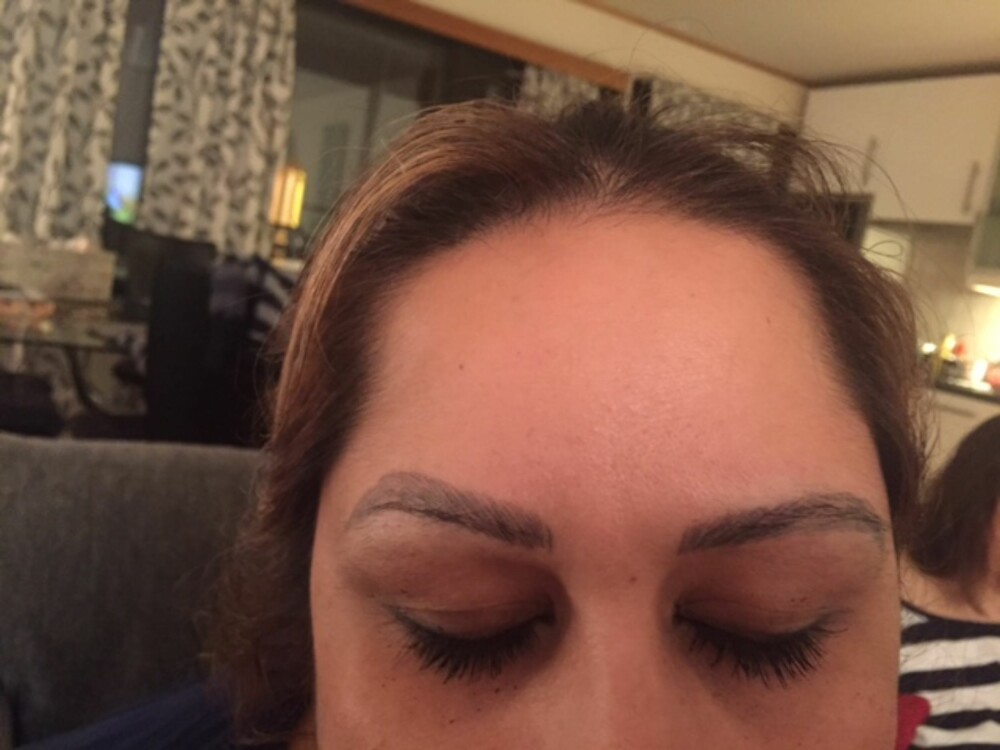 KRISE: Denne kunden sendte bildet til Ekeland og ba om hjelp til å fikse på en dårlig microblading-behandling utført av en norsk distributør og kurssenter. KRISE: Denne kunden sendte bildet til Ekeland og ba om hjelp til å fikse på en dårlig microblading-behandling utført av en norsk distributør og kurssenter.