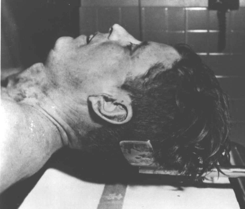 Da liket etter John F. Kennedy kom på obduksjonsbordet, holdt Jackie Kennedy fortsatt en stor del av hjernen hans
i hånden. Da liket etter John F. Kennedy kom på obduksjonsbordet, holdt Jackie Kennedy fortsatt en stor del av hjernen hans
i hånden.