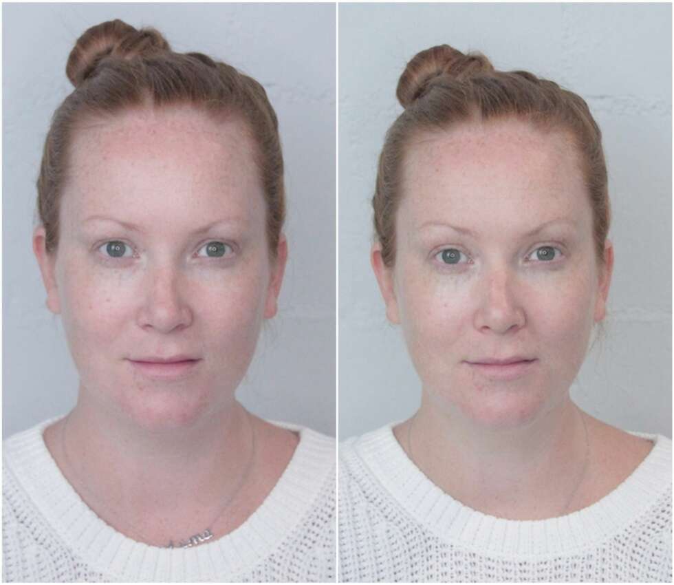 RESULTAT CLARINS: Huden føles myk og god, og hakket lysere, men posene og den mørke ringen er fortsatt de samme. RESULTAT CLARINS: Huden føles myk og god, og hakket lysere, men posene og den mørke ringen er fortsatt de samme.