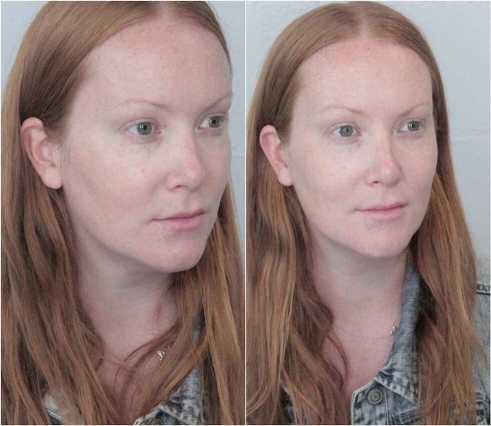 RESULTAT GLAMGLOW: Huden under øynene har fått en lysningseffekt, som produktet lover, men den mørke ringen på høyre øyet virker sterkere og posene er de samme. RESULTAT GLAMGLOW: Huden under øynene har fått en lysningseffekt, som produktet lover, men den mørke ringen på høyre øyet virker sterkere og posene er de samme.