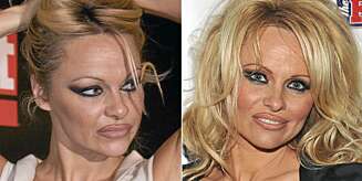 LIPLINER: Pamela Anderson har flere enn én gang brukt en litt for markant lipliner. LIPLINER: Pamela Anderson har flere enn én gang brukt en litt for markant lipliner.