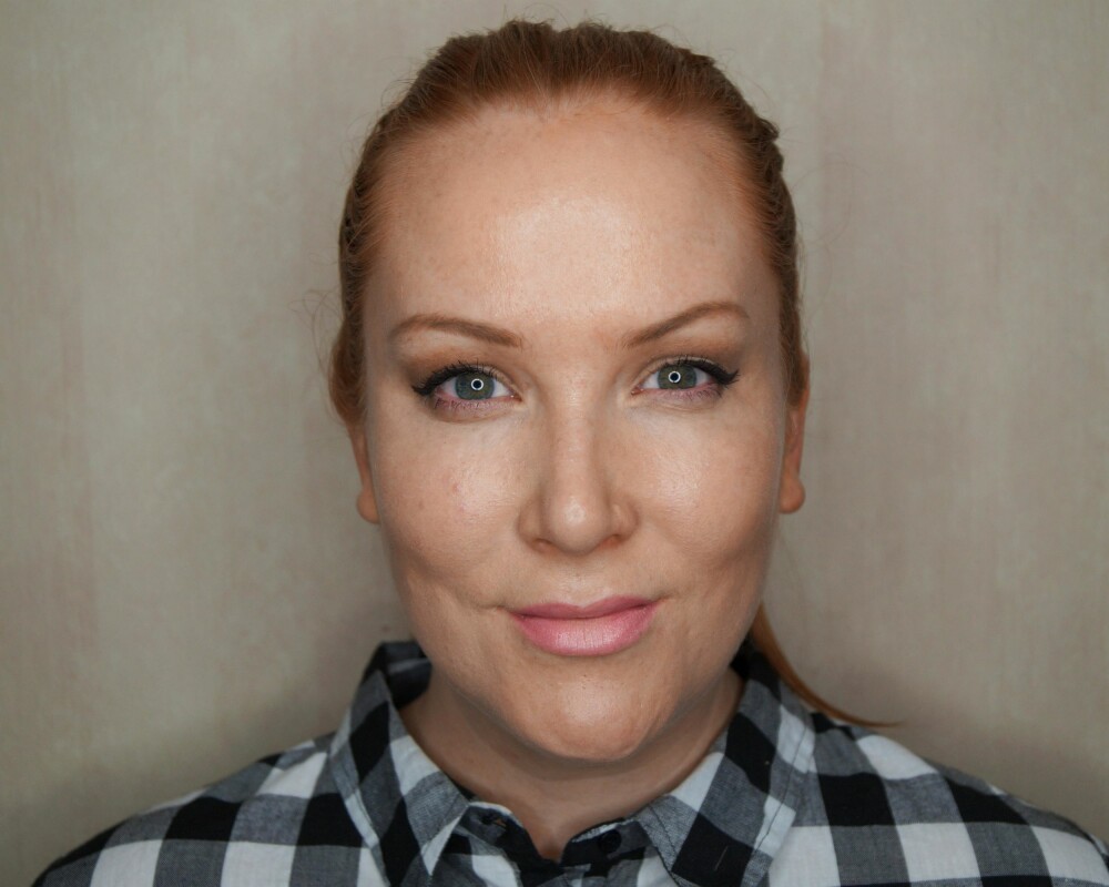 RESULTAT: Fyldige, men tydelig naturlige lepper. RESULTAT: Fyldige, men tydelig naturlige lepper.