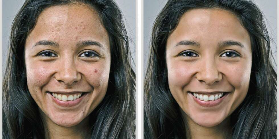 FACETUNE: Slik viser Facetune i et eksempel inne i appen hvordan man kan redigere seg vakrere på 1-2-3. Er det rart vi lar oss lure av sosiale medier?! FOTO: Factune FACETUNE: Slik viser Facetune i et eksempel inne i appen hvordan man kan redigere seg vakrere på 1-2-3. Er det rart vi lar oss lure av sosiale medier?! FOTO: Factune