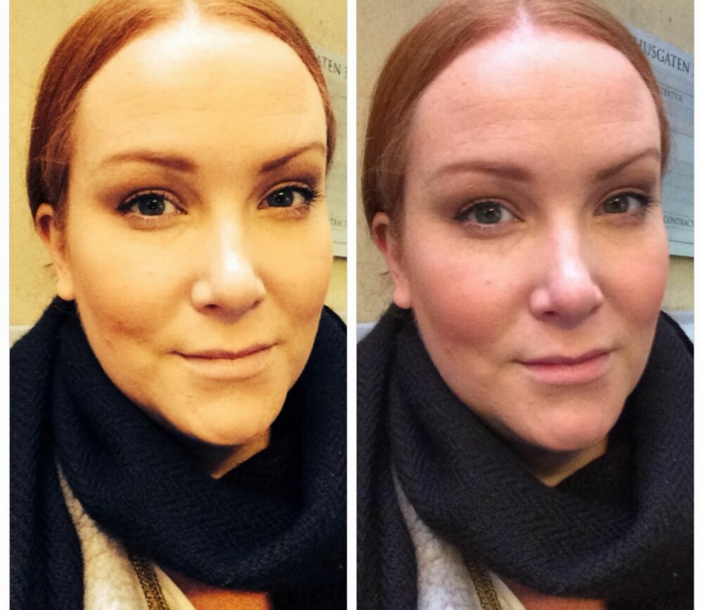 IKKE LA DEG LURE: Dette bilde lastet jeg opp på Instagram med bildeteksten: "Filtere er bare en illusjon - så lenge du er klar over dette for deg selv, og ikke redd for sannheten, så er det helt ok...Det samme gjelder sminke". IKKE LA DEG LURE: Dette bilde lastet jeg opp på Instagram med bildeteksten: "Filtere er bare en illusjon - så lenge du er klar over dette for deg selv, og ikke redd for sannheten, så er det helt ok...Det samme gjelder sminke".