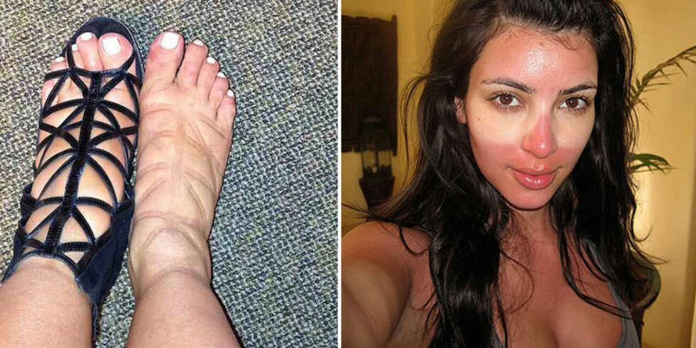 IKKE SÅ LEKKER: Selv Kim Kardashian har kastet seg på "uglies"- trenden og har vist bilder av både hovne gravide-føtter og ligget-for-lenge-i-sola tryne. IKKE SÅ LEKKER: Selv Kim Kardashian har kastet seg på "uglies"- trenden og har vist bilder av både hovne gravide-føtter og ligget-for-lenge-i-sola tryne.