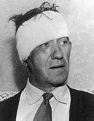 Lokfører Jack Mills måtte sy 14 sting i hodet etter overfallet. Han kom aldri tilbake i jobben. Lokfører Jack Mills måtte sy 14 sting i hodet etter overfallet. Han kom aldri tilbake i jobben.