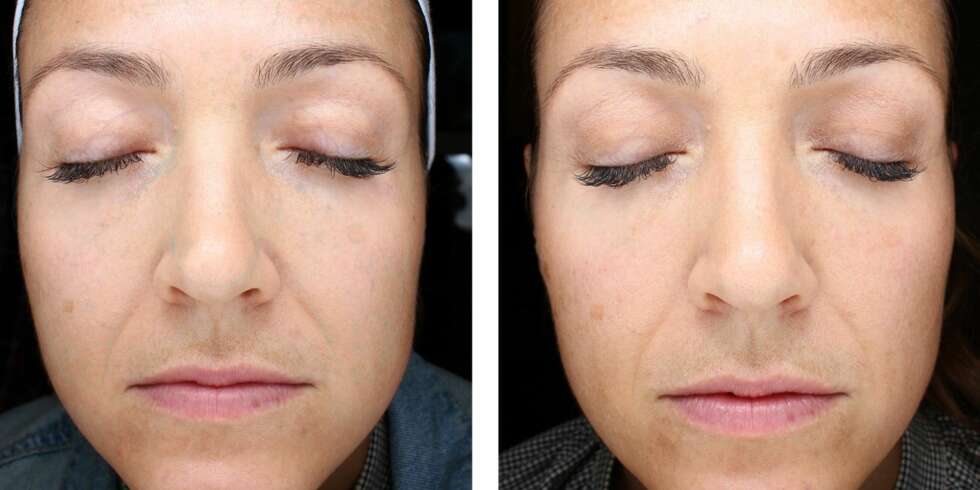 TEST AV POPULÆR HUDPLEIESERIE: Vi testet ZO Skin Health. Her er resultatet. TEST AV POPULÆR HUDPLEIESERIE: Vi testet ZO Skin Health. Her er resultatet.