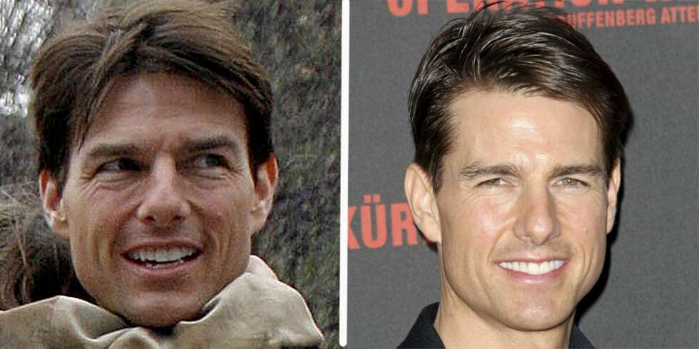 FRA RYNKETE TIL GLATT: En markant forandring på få måneder. Rynkene er borte og Tom Cruise ser plutselig svært så ung ut i ansiktet. Ryktene vil ha det til at han har fått hjelp av kirurgen. FRA RYNKETE TIL GLATT: En markant forandring på få måneder. Rynkene er borte og Tom Cruise ser plutselig svært så ung ut i ansiktet. Ryktene vil ha det til at han har fått hjelp av kirurgen.