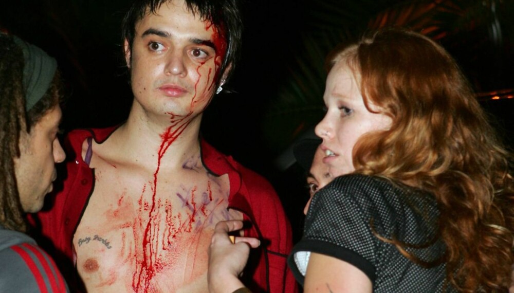 Pete Doherty Pete Doherty