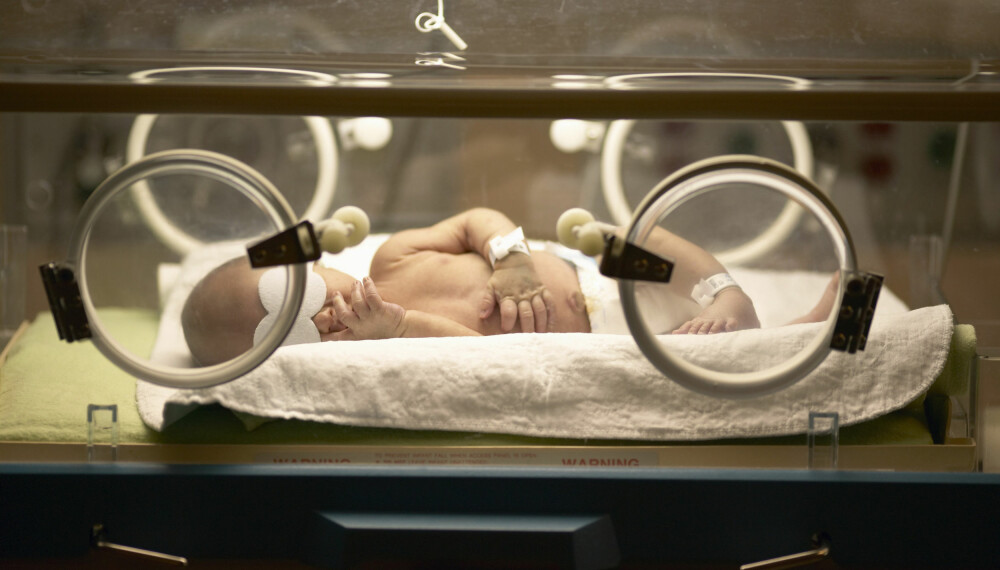 GULSOTT HOS BABY: Vet du egentlig hva gulsott er, og hvordan det behandles? Gulsott kan nemlig være forklaringen på babyens gulfarge. Foto: Gettyimages.com. GULSOTT HOS BABY: Vet du egentlig hva gulsott er, og hvordan det behandles? Gulsott kan nemlig være forklaringen på babyens gulfarge. Foto: Gettyimages.com.
