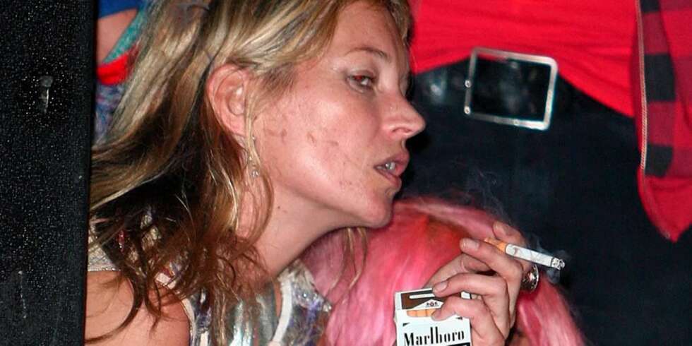 FET OG UREN HUD: Også supermodeller sliter med hudproblemer, det er Kate Moss et godt eksempel på FET OG UREN HUD: Også supermodeller sliter med hudproblemer, det er Kate Moss et godt eksempel på
