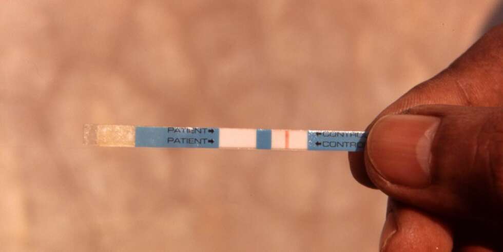HIV-TEST: Positvt utslag er svært negativt... HIV-TEST: Positvt utslag er svært negativt...