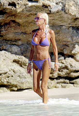 HOLDER STAND: Puppene til Donatella Versace står ikke helt i stil til resten av kroppen. HOLDER STAND: Puppene til Donatella Versace står ikke helt i stil til resten av kroppen.