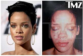 SKAMBANKET: Rihanna skal ha blitt kraftig mishandlet av kjæresten, Chris Brown. SKAMBANKET: Rihanna skal ha blitt kraftig mishandlet av kjæresten, Chris Brown.