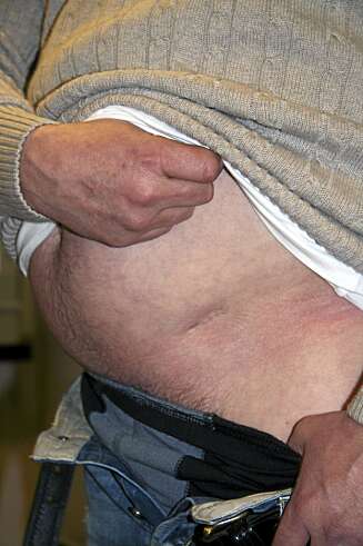 SKUTT I MAGEN: Et liv som kriminell setter sine spor... SKUTT I MAGEN: Et liv som kriminell setter sine spor...