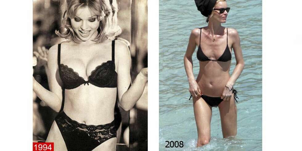TYNNERE OG TYNNERE: Eva Herzigova slo igjennom som den formfulle modellen for Wonderbra i 1994. I 2008 har hun blitt betraktelig tynnere. TYNNERE OG TYNNERE: Eva Herzigova slo igjennom som den formfulle modellen for Wonderbra i 1994. I 2008 har hun blitt betraktelig tynnere.
