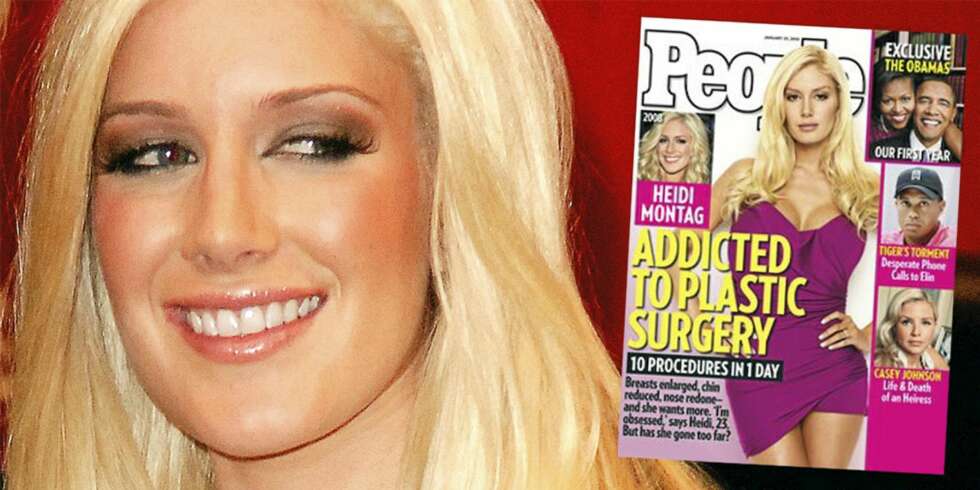 OPERERT: Heidi Montag er ikke til å kjenne igjen etter operasjonene. OPERERT: Heidi Montag er ikke til å kjenne igjen etter operasjonene.