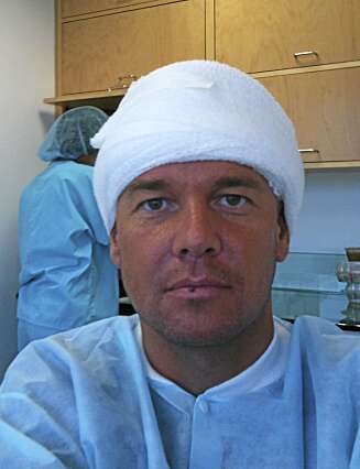 BANDASJERT: De som så Kristian Valen komme opp av vannet etter ulykken, trodde han var blitt utsatt for et haiangrep. På Santa Monica Medical ble han både sydd og bandasjert. BANDASJERT: De som så Kristian Valen komme opp av vannet etter ulykken, trodde han var blitt utsatt for et haiangrep. På Santa Monica Medical ble han både sydd og bandasjert.